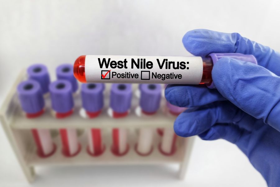A vial in a medical laboratory containing the West Nile Virus.